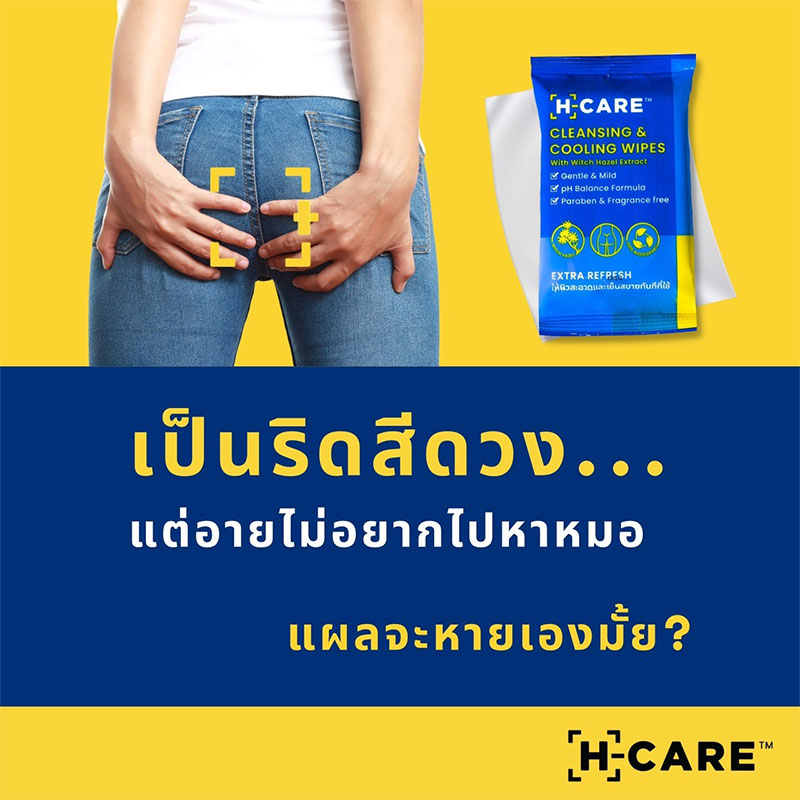 เป็นริดสีดวง…แต่อายไม่อยากไปหาหมอ แผลจะหายเองได้ไหม?